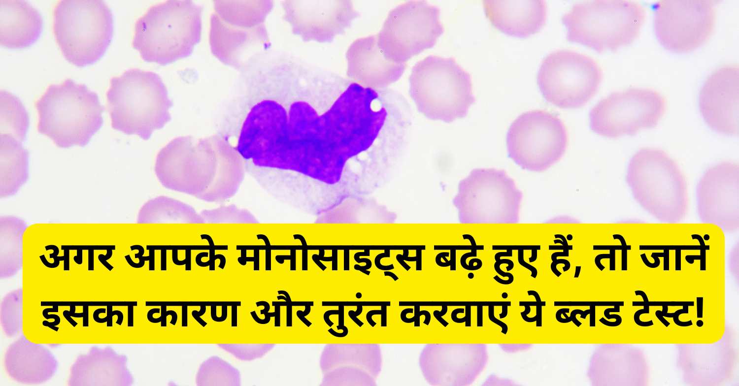 What Is Monocytes In Blood Test: अगर आपके मोनोसाइट्स बढ़े हुए हैं, तो जानें इसका कारण और तुरंत करवाएं ये ब्लड टेस्ट!